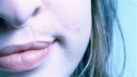 labio
