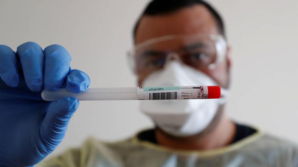 has-tenido-covid-19-los-test-que-decidiran-si-sales-de-casa-o-no-tras-el-confinamiento