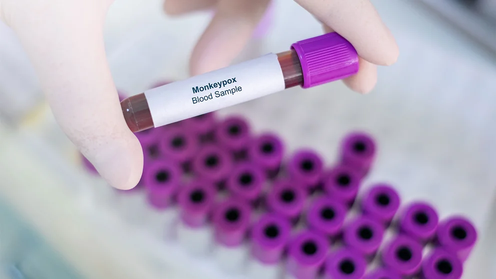 55NI7LYT6JG6JPP3JD532VVU5A