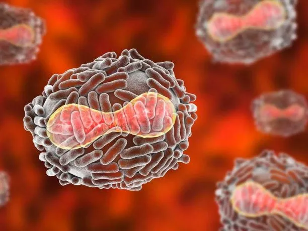 viruela-del-mono-infeccionjpg