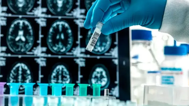 alzheimerjpg