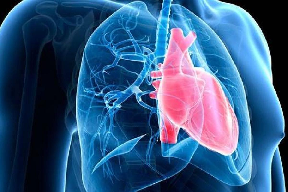 hipertensionpulmonar