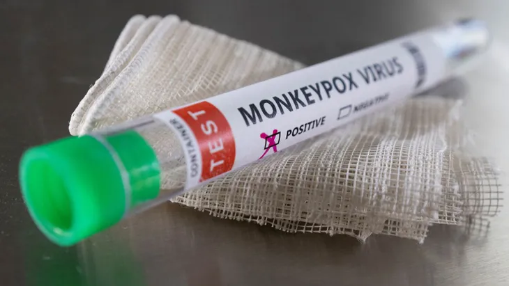 viruela-del-mono-test
