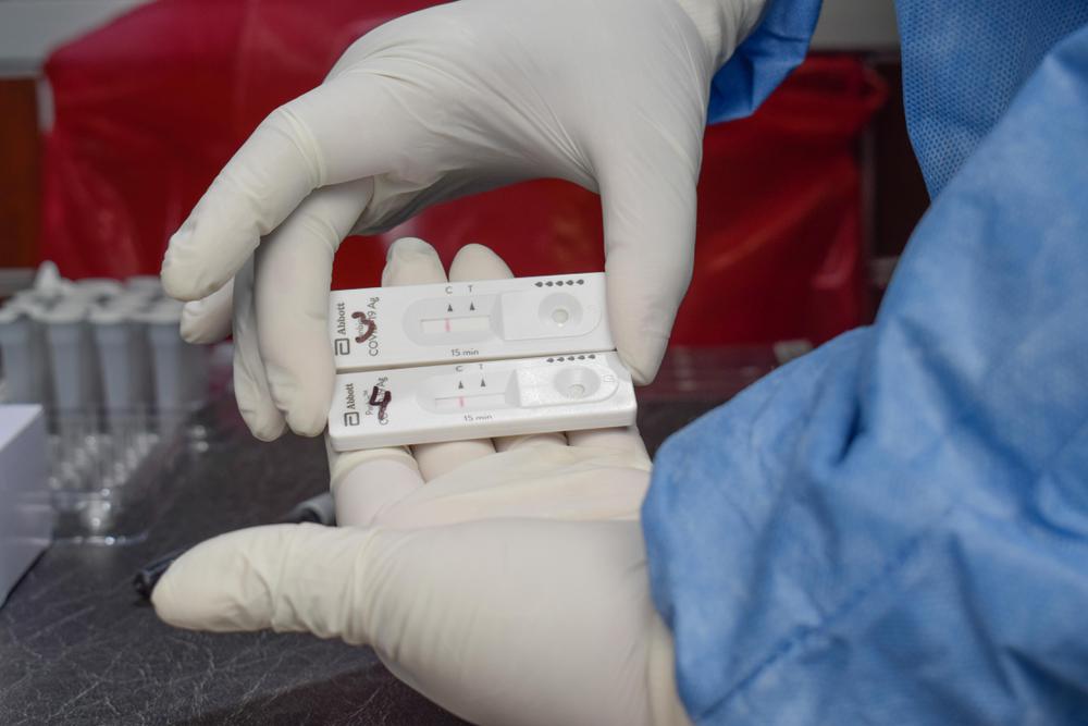 SAL_HISOPADOS DETECCION RAPIDA_16_03 (20)