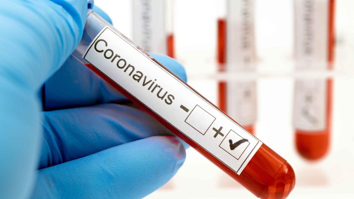 Coronavirus-positivo