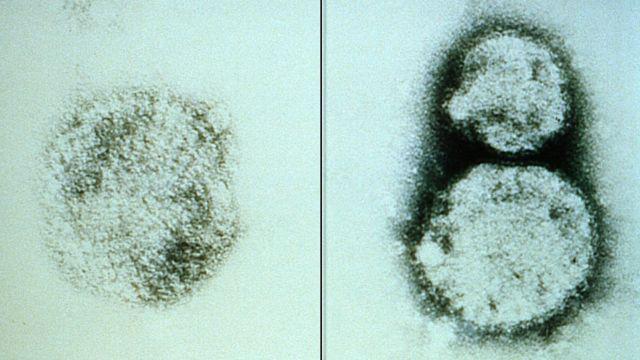 _105205185_f5b0f61f-c4e4-4146-bb1e-0e52e3f63a97