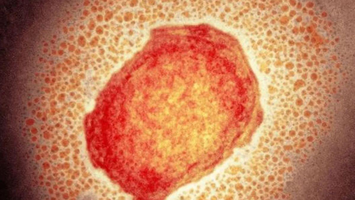 pequena-particula-virus-viruela-mono-943997-090950