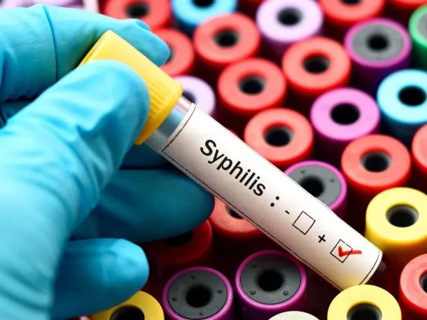 sifilis
