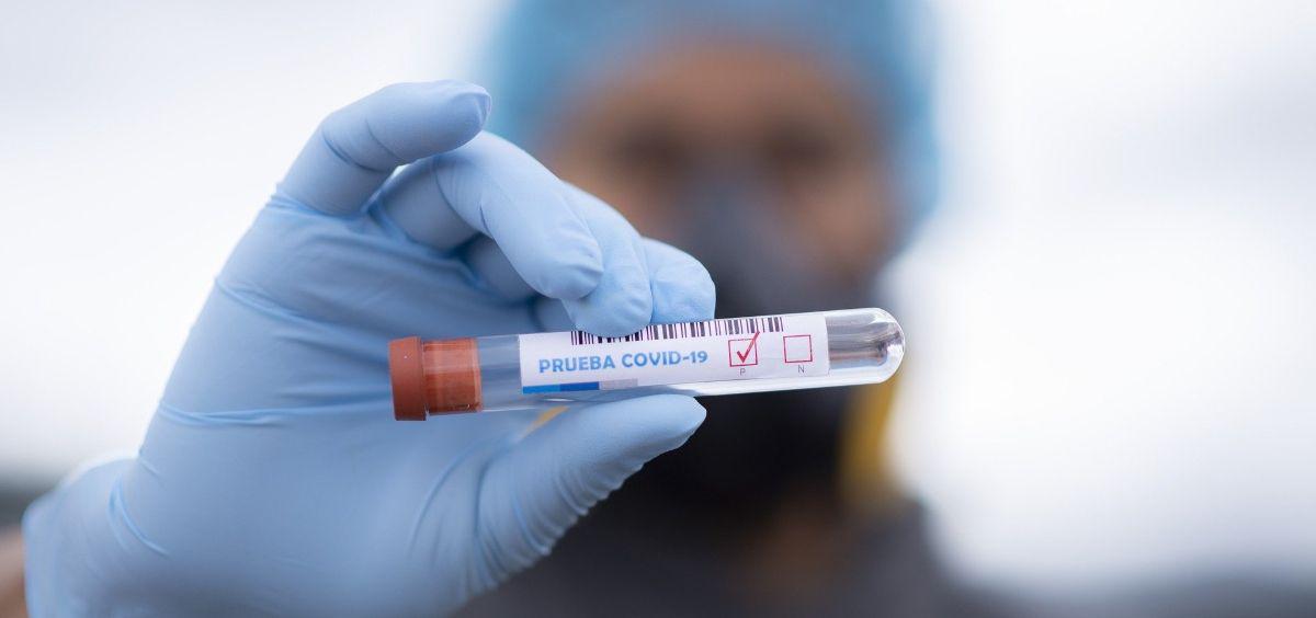 test-coronavirus-covid-19-foto-pixabay
